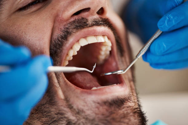 Best Pediatric Emergency Dentist in North Fort Lewis, WA