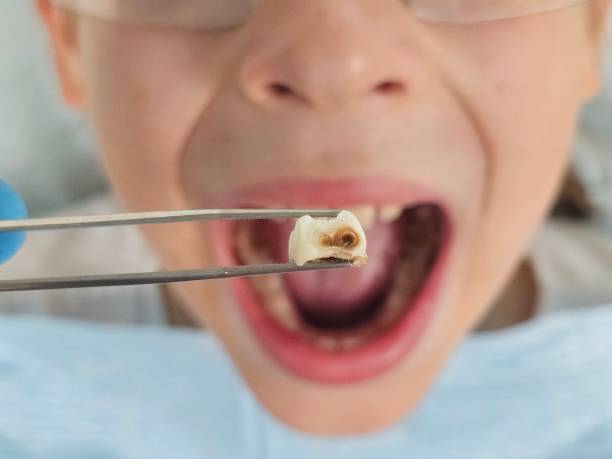 Best Emergency Dental Services for Seniors in North Fort Lewis, WA